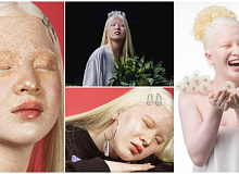 albino-devojka-01.jpg