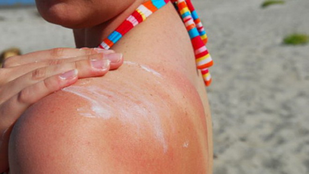 zosto-sme-alergicni-na-sonce-01