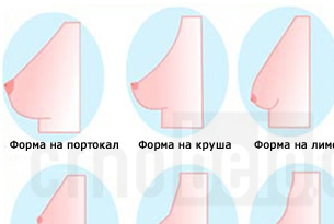 kakva-forma-imaat-vasite-gradi-povekje