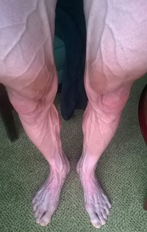 fotografija-za-koja-zboruva-celiot-svet-vaka-izgledaat-nozete-na-velosipedist-po-tour-de-france-02.jpg