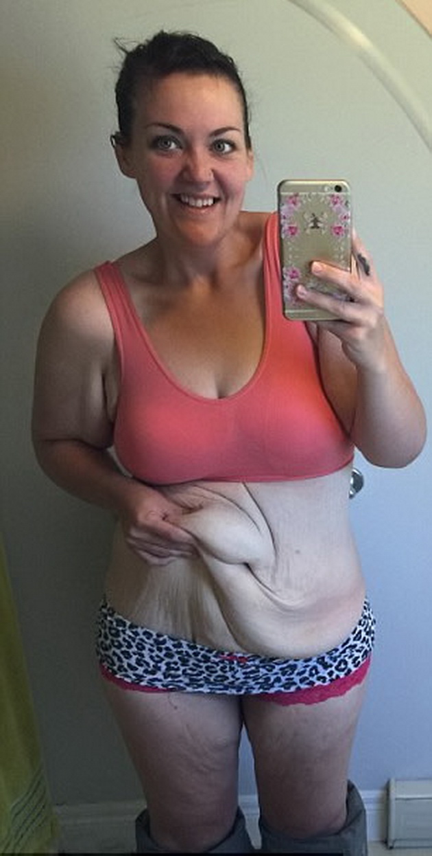devojka-za-prvpat-vo-zivotot-obalak-bikini-otkako-izgubila-95-kilogrami-5.jpg
