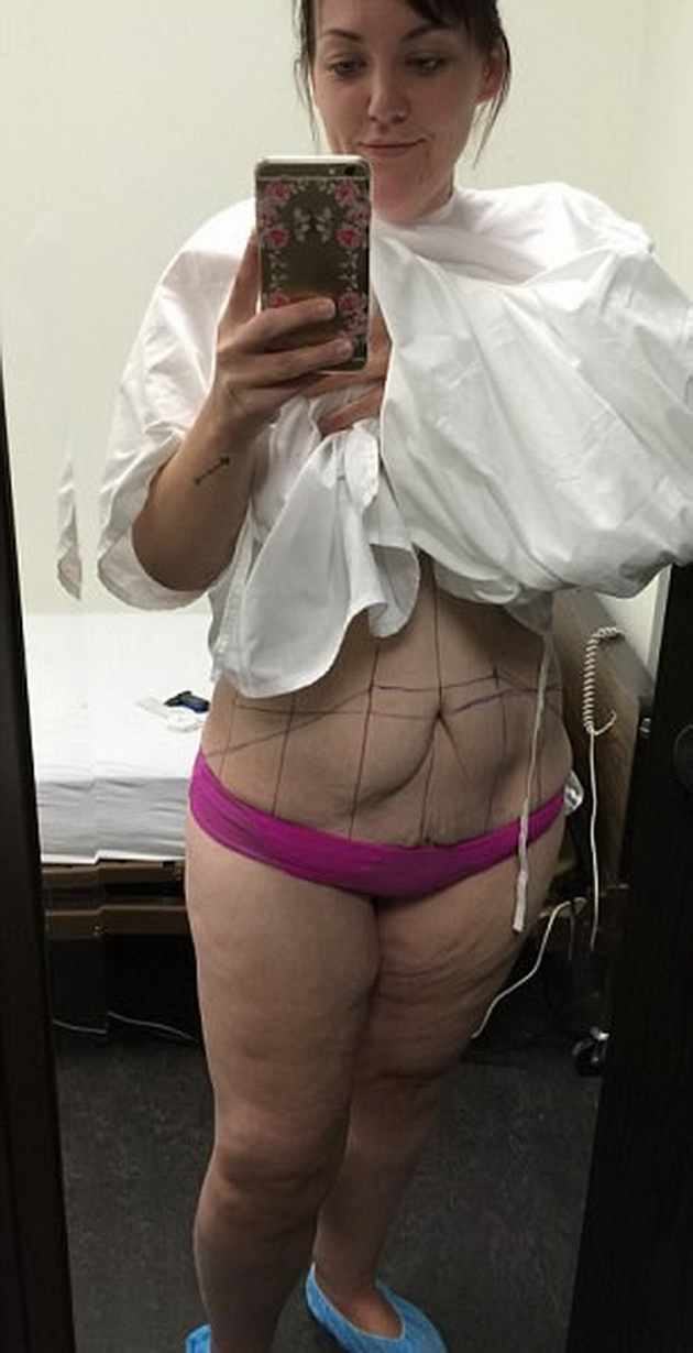 devojka-za-prvpat-vo-zivotot-obalak-bikini-otkako-izgubila-95-kilogrami-6.jpg