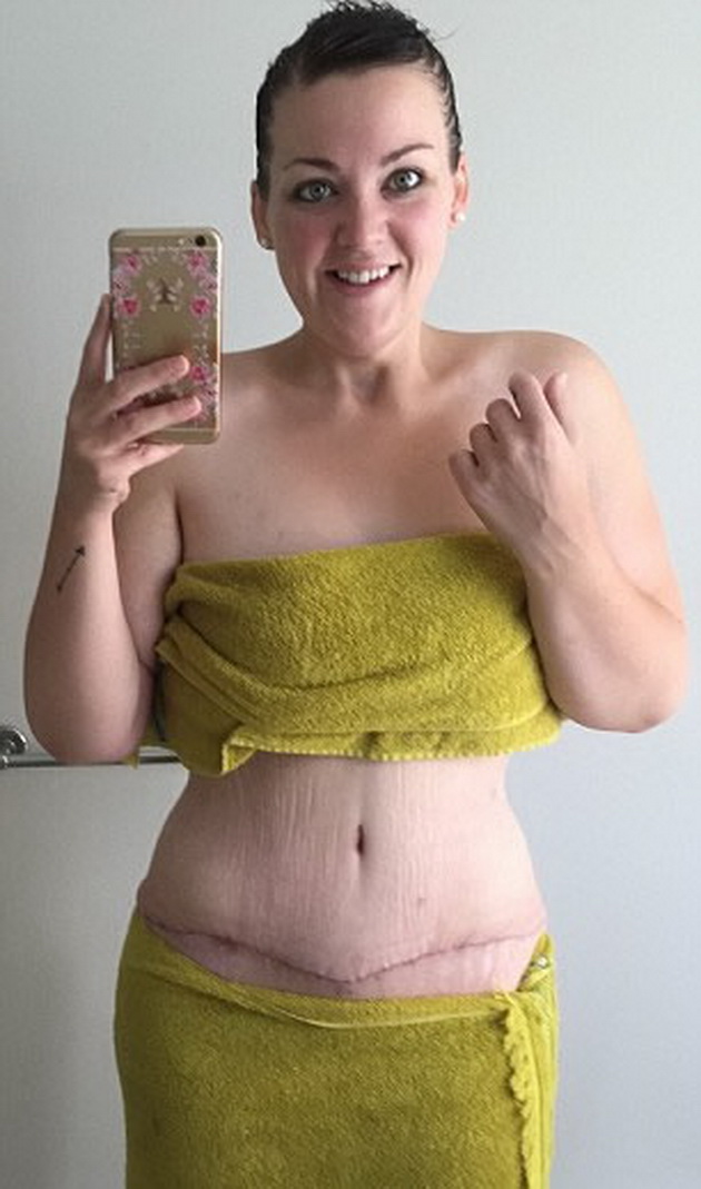 devojka-za-prvpat-vo-zivotot-obalak-bikini-otkako-izgubila-95-kilogrami-7.jpg