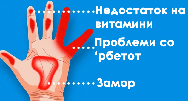 zoshto-vi-trnat-odredeni-delovi-od-racete-i-kako-da-si-pomognete-01.jpg