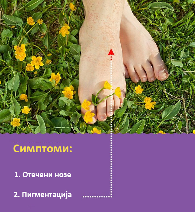 problemi-so-nozete-koi-ne-treba-da-gi-ignorirate-003.jpg
