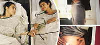 selena-gomez-otkri-deka-imala-transplantacija-na-bubreg-povekje01.jpg