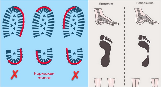 5-pokazateli-deka-odenjeto-vi-e-nepravilno-001.jpg