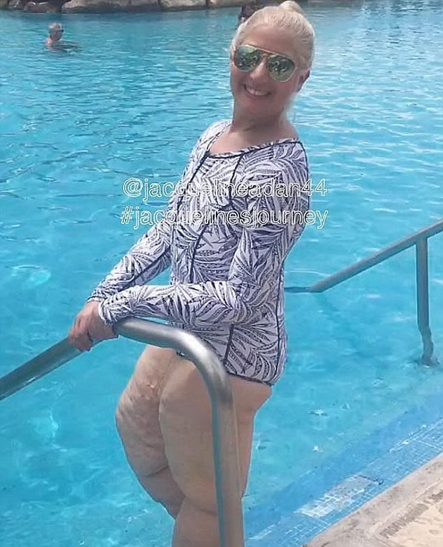 zena-koja-oslabela-150-kilogrami-za-prvpat-oblekuva-kostim-za-kapenje-03.jpg