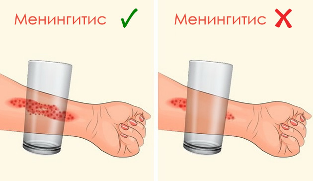 7-simptomi-na-meningitit-koi-sekoj-roditel-treba-da-gi-znae-08.jpg