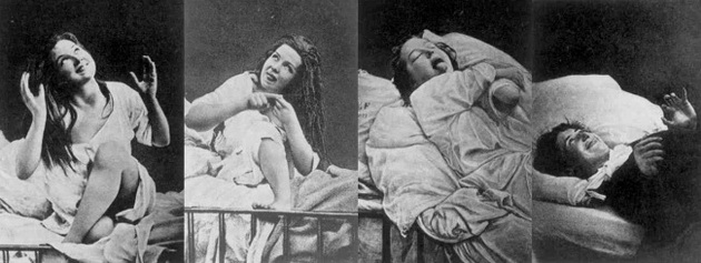 7-zastrashuvachki-metodi-so-koi-nashite-predci-gi-tretirale-mentalnite-bolesti-09.jpg