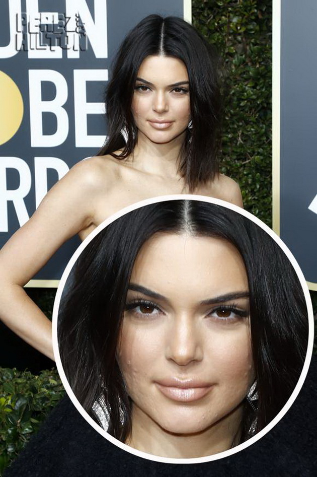 kendall-jenner-odblisku-so-akni-po-liceto-na-crven-tepih-2-1.jpg