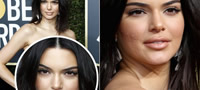 kendall-jenner-odblisku-so-akni-po-liceto-na-crven-tepih-povekje.jpg
