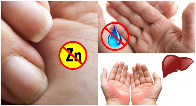 potenje-crvenilo-peckanje-znaci-na-dlankite-koi-otkrivaat-zdravstveni-problemi-01.jpg