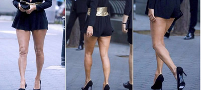 kako-se-sheta-celulit-na-modna-revija-so-gordost-povekje.jpg