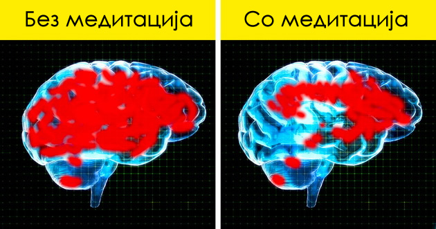 osloboduva-od-loshi-naviki-i-namaluva-bolka-6-prichini-zoshto-da-pochnete-da-meditirate-ushte-denes-02.jpg