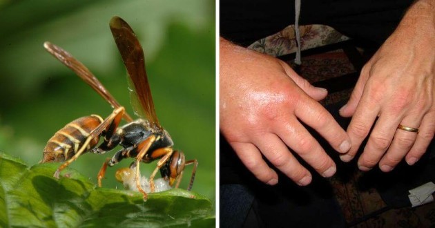 Kako-da-gi-raspoznaete-najcestite-kasnuvanja-od-insekti (5).jpg