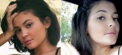 kylie-jenner-gi-izvadi-filerite-konecno-lici-na-20godisna-devojka-povekje.jpg
