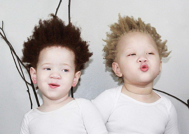 afroamerikanski-par-ima-albino-bliznachinja-i-site-gi-prashuvaat-dali-se-nivni-foto-08.jpg