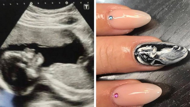 hit-pomegju-trudnicite-manikir-so-ultrazvuk-slika-od-bebeto-001.jpg
