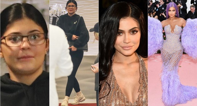 kylie-jenner-neprepoznatliva-bez-shminka-na-stomatoloshki-pregled-foto-01.jpg