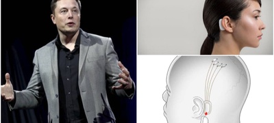 ilon-mask-go-pretstavi-mozochniot-implant-so-kojshto-kje-mozhete-da-ja-kontrolirate-tehnologijata-01_400x180.jpg