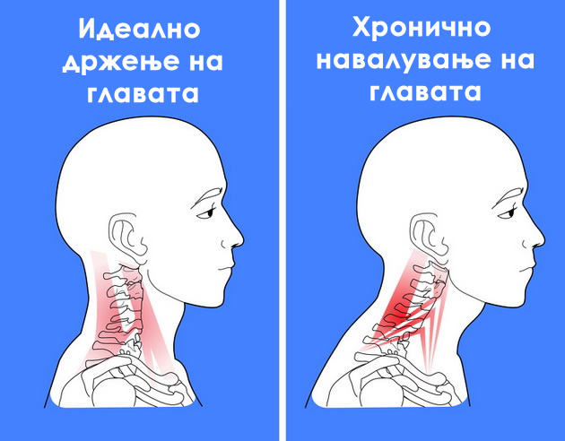 zosto-mladite-denes-imaat-koska-plus-na-zadniot-del-od-glavata-03.jpg