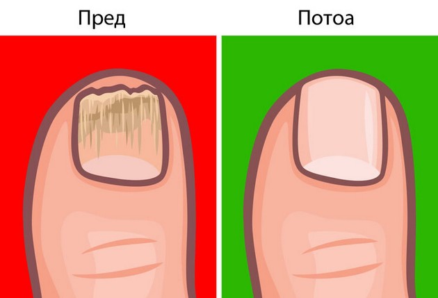 ednostavni-trikovi-za-spravuvanje-so-najchestite-problemi-so-noktite-04.jpg