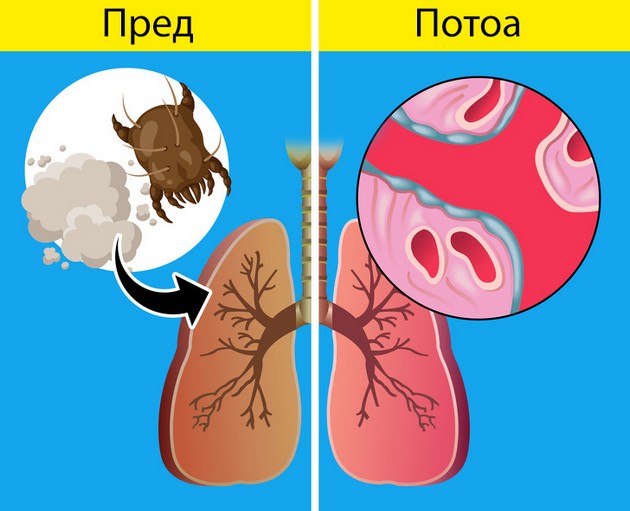 znaci-deka-treba-da-obrnete-vnimanie-na-zdravjeto-na-belite-drobovi-10.jpg