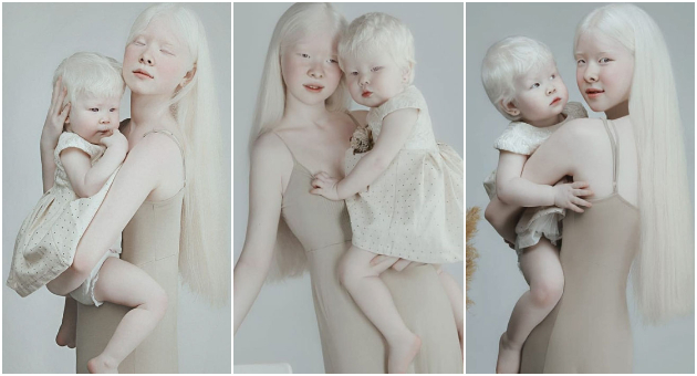 albino-sestri-go-osvojvuaat-svetot-so-nivnata-neobichna-ubavina-01.jpg