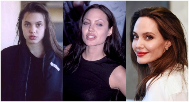 burniot-zhivot-na-angelina-jolie-niz-fotografii-01.JPG