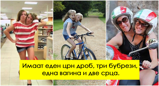 kako-izgleda-zivotot-na-30-godisnite-sijamski-bliznacki-fenomen-nesfatliv-i-za-naucnicite-01.jpg