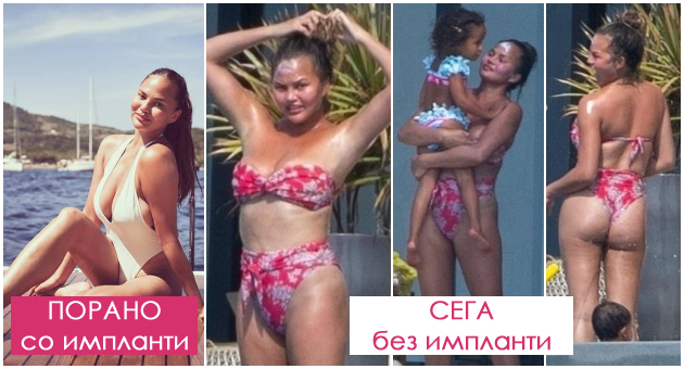 prvi-fotki-od-krisi-otkako-gi-izvadi-implantite-na-gradi-gorda-na-svoeto-bikini-telo-01.jpg