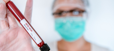 sostoba koronavirus makedonija do 14 08 2020 povekje