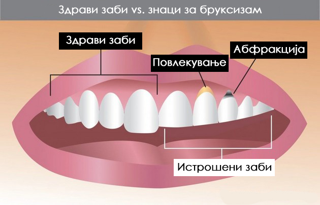 zoshto-gi-triete-zabite-i-kako-da-se-oslobodite-od-ovaa-navika-02.jpg