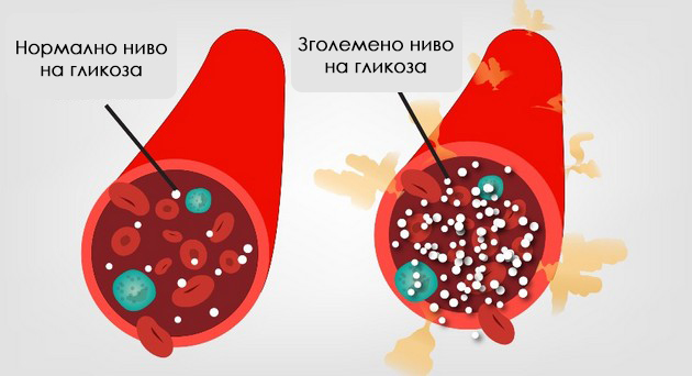 shto-e-hiperglikemija-i-koi-se-najchestite-znaci-i-simptomi-03.jpg