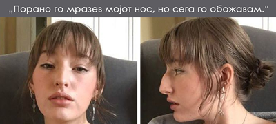 10-devojki-koi-nauchile-da-gi-sakaat-svoite-nesovrsheni-nosevi-01povekje.jpg