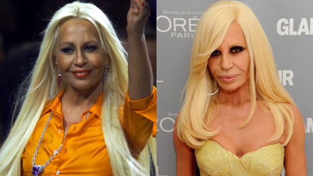 kako-izgledase-donatela-versace-pred-da-se-unisti-so-plasticni-operacii-06.jpg