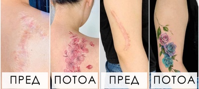 tatu-artistka-od-vietnam-im-pomaga-na-zhenite-da-gi-pokrijat-luznite-na-teloto-so-tetovazhi-i-da-si-ja-vratat-samodoverbata-foto-POVEKJE.jpg