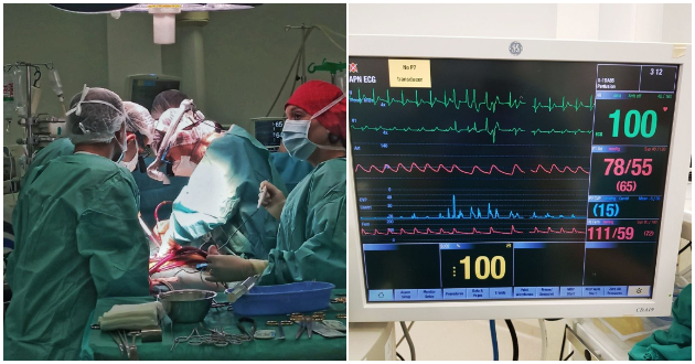 uspeshno-izvrshena-4-ta-transplantacija-na-srce-vo-makedonija-srceto-na-44-godishna-pochinata-pacientka-povtorno-zachuka-01.jpg