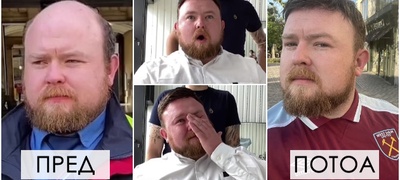 emotivno-video-29-godishen-vozach-prvpat-dobi-perika-po-10-godini-pominati-bez-kosa-POVEKJE.jpg