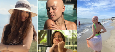cece-nikolova-24-alopecijata-mi-pomogna-da-izgradam-samodoverba-a-rastenjeto-bez-roditelska-grizha-me-zajakna-01povekje.fw.png