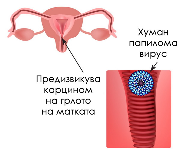 d-r-jasmina-veta-darkovski-ginekolog-za-crnobelo-com-s-shto-treba-da-znaete-za-karcinom-na-grloto-na-matkata-07.jpg