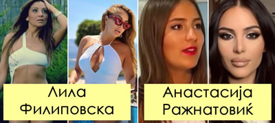 makedonskite-i-regionalni-dami-pred-i-po-estetskite-zafati-i-korekcii-povekje01.jpg