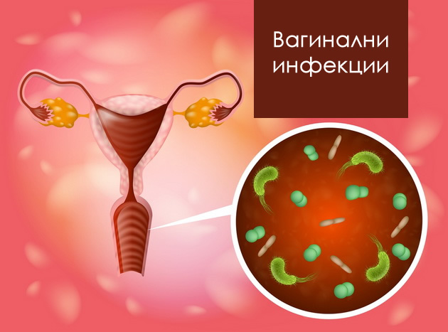 najchesti-vaginalni-problemi-simptomi-i-soveti-za-odrzhuvanje-vaginalna-higiena-otkriva-d-r-jasmina-veta-darkovski-za-crnobelo-com-02.jpg