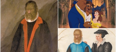 stradal-od-sindrom-na-vrkolak-go-tretirale-kako-zhivotno-potresnata-prikazna-na-mazhot-koj-e-inspiracija-za-ubavicata-i-dzverot-povekje.jpg