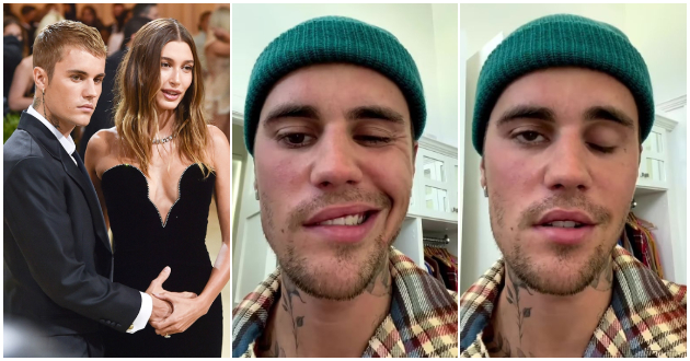 molete-se-za-mene-djastin-biber-ima-redok-sindrom-koj-mu-go-paralizira-liceto-ne-mozhe-da-trepka-i-da-se-smee-video-01.jpg