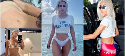 kim-kardashijan-e-opsednata-so-slabeenje-po-dietata-shto-go-vloshi-zdravjeto-pravam-bolni-laserski-tretmani-no-vredi-povekje.jpg