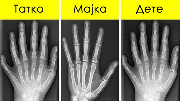 nekoi-pijavici-imaat-32-mozoci-i-ushte-9-zabavni-fakti-10.jpg