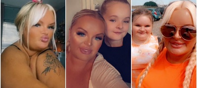 anglichanka-so-retko-genetsko-narushuvanje-nema-kluchni-koski-mozhe-da-si-gi-dopre-ramenata-edno-so-drugo-foto-video-povekje.jpg