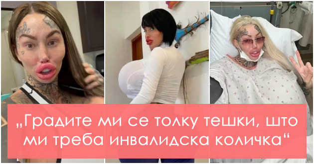 bizarno-zavisnichka-od-plastichni-operacii-mora-da-koristi-invalidksa-kolichka-poradi-implantite-rechisi-umrela-od-nelegalni-injekcii01.jpg